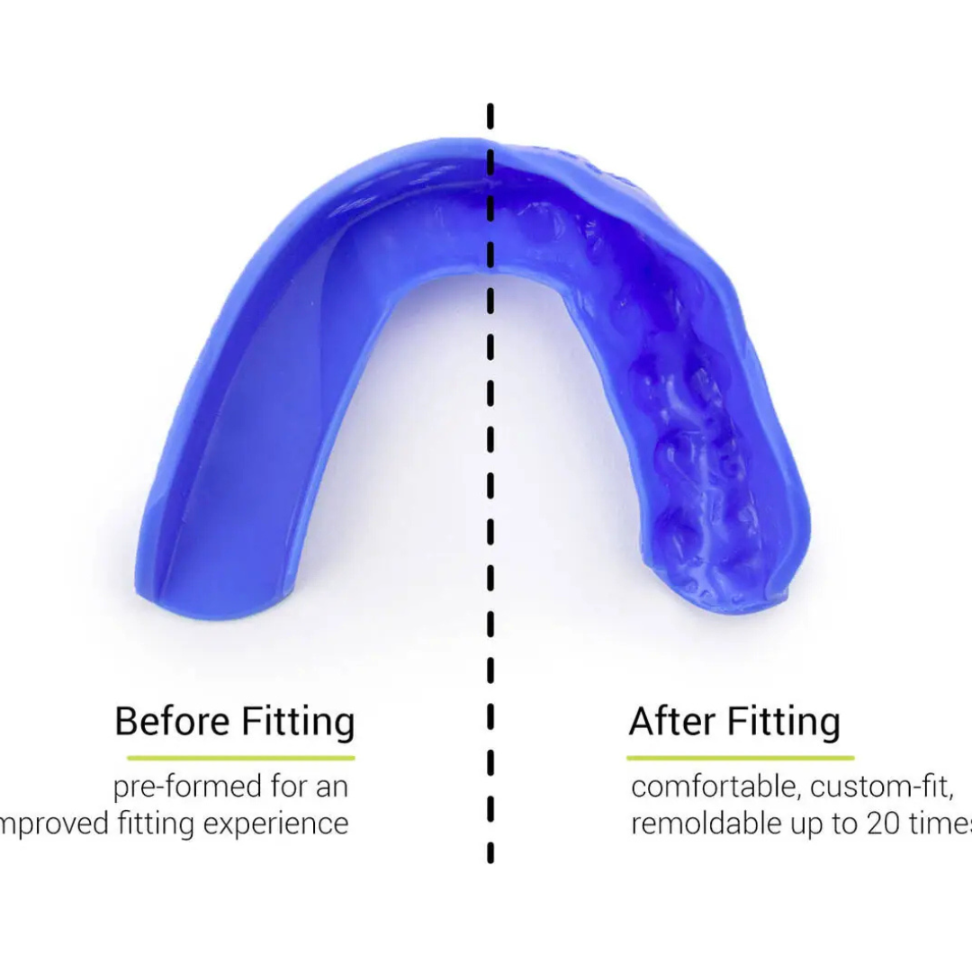 Sisu 3D Paradenti after